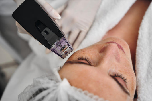 Microneedling/RF Face and Neck